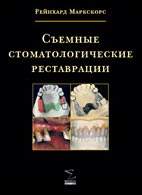 Скачать бесплатно книгу "Съемные стоматологические реставрации", Рейнхард Маркскорс.