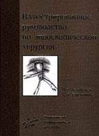 Скачать бесплатно книгу "Иллюстрированное руководство по эндоскопической хирургии", Емельянов С.И.