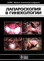 На фото Лапароскопия в гинекологии - Савельева Г.М. - Практическое пособие