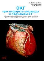 Скачать бесплатно книгу «ЭКГ при инфаркте миокарда с подъемом ST», Де Луна А.Б.