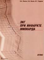 Скачать бесплатно книгу «ЭКГ при инфаркте миокарда», Люсов В.А.