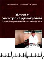Скачать бесплатно книгу: Атлас электрокардиограмм с унифицированными заключениями, Домницкая Т.М.