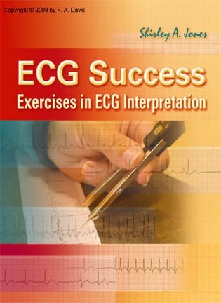 ECG Success: Exercises in ECG Interpretation - Shirley A. Jones