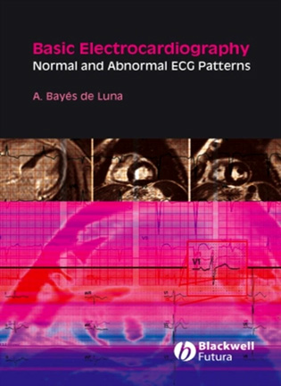 Basic electrocardiography: normal and abnormal ECG patterns - Antoni Bayes de Luna