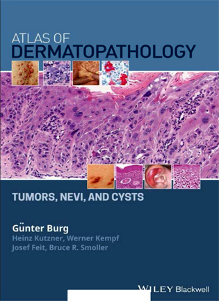 Atlas of Dermatopathology: Tumors, Nevi, and Cysts - Gunter Burg