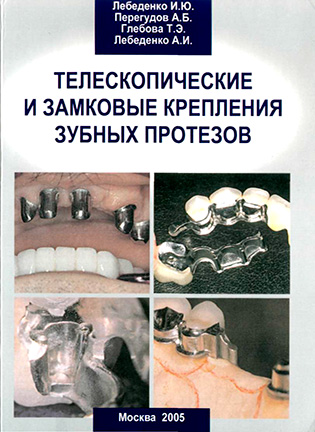 Телескопические и замковые крепления зубных протезов - Лебеденко И.Ю.