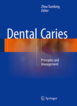 Dental Caries: Principles and Management - Zhou Xuedong