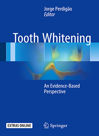 Tooth Whitening -  Jorge Perdigão