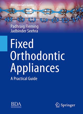 Fixed Orthodontic Appliances - Padhraig  Fleming, Jadbinder Seehra
