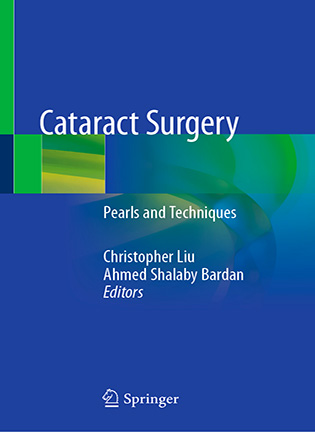 Cataract Surgery - Christopher Liu, Ahmed Shalaby Bardan