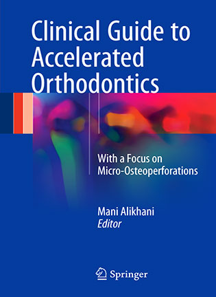 Clinical Guide to Accelerated Orthodontics - Mani Alikhani