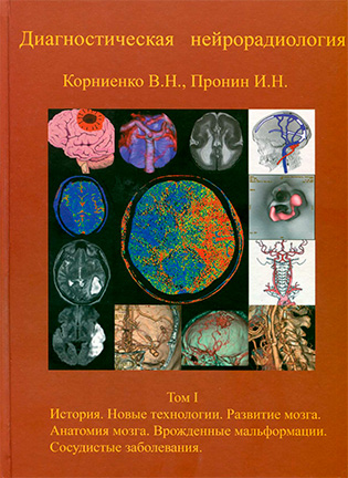 Диагностическая нейрорадиология - Корниенко В.Н., Пронин И.Н. - Том 1