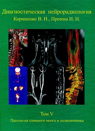 Диагностическая нейрорадиология - Корниенко В.Н., Пронин И.Н. - Том 5