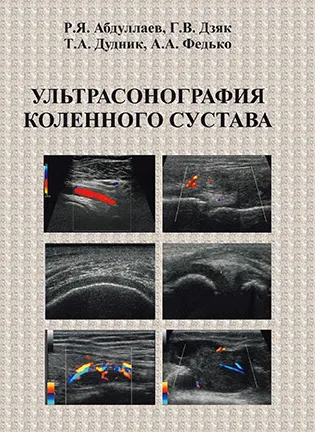 Ультрасонография коленного сустава - Абдуллаев Р.Я.