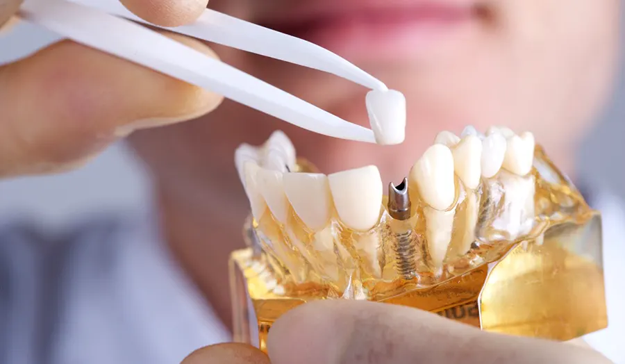 Особенности ортопедической стоматологии