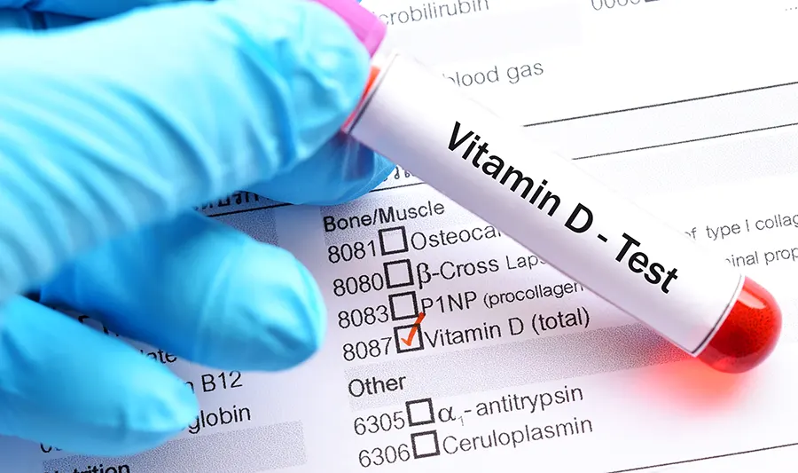 Профилактика и лечение дефицита витамина D: выбор оптимального подхода