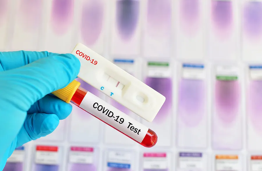 Тест на коронавирус COVID-19