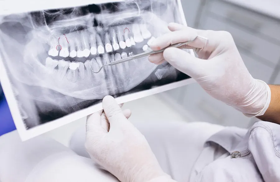 Современная стоматология Polimagia.by: польза для зубов и борьба с кариесом