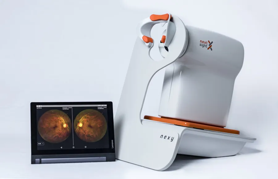 На фото Окно в мир офтальмологии: технологии диагностики глазного дна