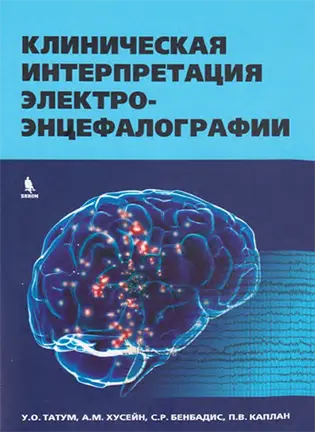 На фото Клиническая интерпретация электроэнцефалографии - Татум У.О. - Справочник