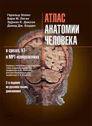 На фото Атлас анатомии человека в срезах КТ- и МРТ-изображениях - Гарольд Эллис