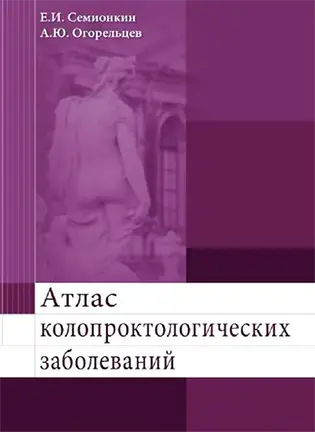 На фото Атлас колопроктологических заболеваний - Семионкин Е.И. - Учебное пособие