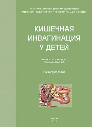 На фото Кишечная инвагинация у детей - Дьяконова Е.Ю. - Учебное пособие