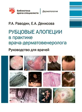 Рубцовые алопеции в практике врача-дерматовенеролога - Раводин Р.А.