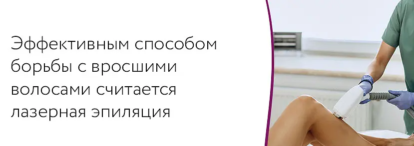лазерная эпиляция – методы борьбы с вросшими волосами