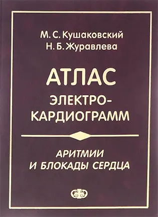 Аритмии и блокады сердца: атлас электрокардиограмм - Кушаковский М. С.