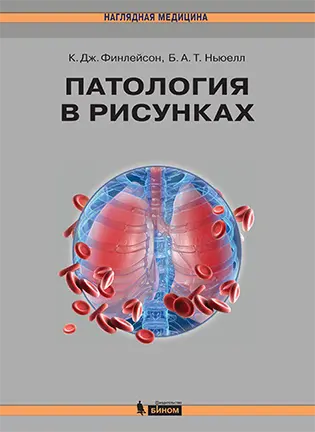 Патология в рисунках - Финлейсон К. Дж.
