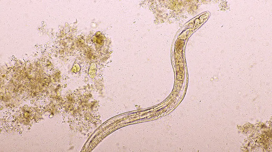 Ascaris lumbricoides